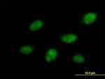 CDC14B Antibody in Immunocytochemistry (ICC/IF)