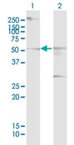 CDC14B Antibody in Western Blot (WB)