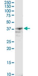 B4GALT4 Antibody in Western Blot (WB)