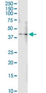 B4GALT4 Antibody in Western Blot (WB)