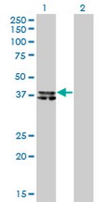 B4GALT4 Antibody in Western Blot (WB)