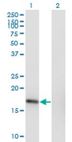 SNX3 Antibody in Western Blot (WB)