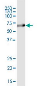 SQSTM1 Antibody in Western Blot (WB)