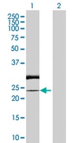 RAB7L1 Antibody in Western Blot (WB)