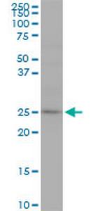 RAB7L1 Antibody in Western Blot (WB)