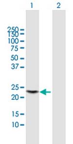 PGLYRP1 Antibody in Western Blot (WB)