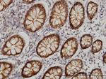 CLDN1 Antibody in Immunohistochemistry (Paraffin) (IHC (P))