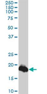 CLDN1 Antibody in Western Blot (WB)