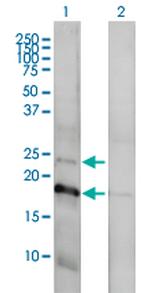 CLDN1 Antibody in Western Blot (WB)