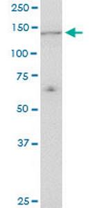 UBE4A Antibody in Western Blot (WB)