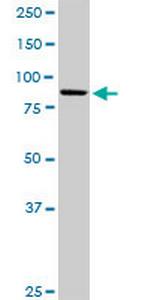 KIF3B Antibody in Western Blot (WB)