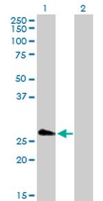 FHL5 Antibody in Western Blot (WB)