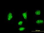 HAND2 Antibody in Immunocytochemistry (ICC/IF)