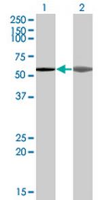 AKAP5 Antibody in Western Blot (WB)