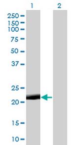 PAGE4 Antibody in Western Blot (WB)