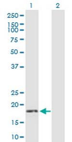 GUCA1C Antibody in Western Blot (WB)