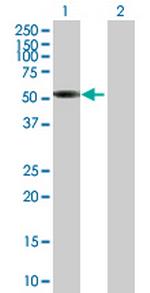 SNX17 Antibody in Western Blot (WB)