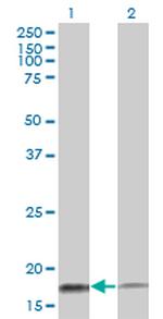 TOMM20 Antibody in Western Blot (WB)