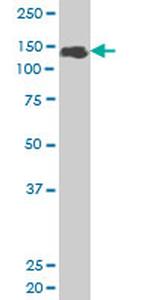 ZFHX1B Antibody in Western Blot (WB)