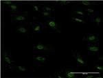 ZFHX1B Antibody in Immunocytochemistry (ICC/IF)