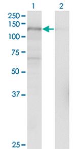 USP15 Antibody in Western Blot (WB)