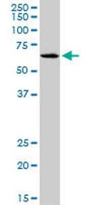 SLC17A4 Antibody in Western Blot (WB)