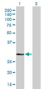 DHRS9 Antibody in Western Blot (WB)