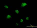 RBM6 Antibody in Immunocytochemistry (ICC/IF)