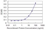 ZNF238 Antibody in ELISA (ELISA)