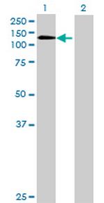 PITRM1 Antibody in Western Blot (WB)