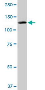 PITRM1 Antibody in Western Blot (WB)