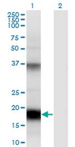 UBD Antibody in Western Blot (WB)