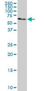 AHCYL1 Antibody in Western Blot (WB)