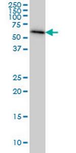 AHCYL1 Antibody in Western Blot (WB)