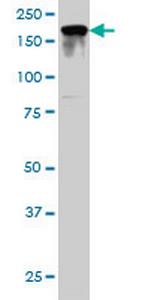 IQGAP2 Antibody in Western Blot (WB)