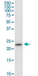 PGRMC1 Antibody in Western Blot (WB)