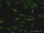 PRDX3 Antibody in Immunocytochemistry (ICC/IF)