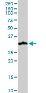 NUDT21 Antibody in Western Blot (WB)