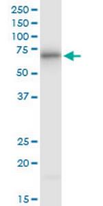 ATE1 Antibody in Western Blot (WB)