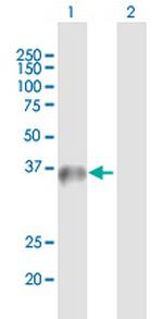 WDR45 Antibody in Western Blot (WB)