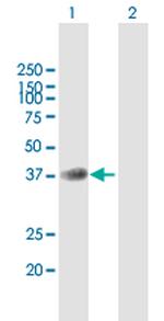 B4GALT7 Antibody in Western Blot (WB)