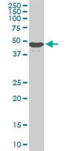 STK38 Antibody in Western Blot (WB)