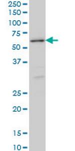 STK38 Antibody in Western Blot (WB)