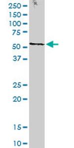 STK38 Antibody in Western Blot (WB)