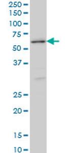 STK38 Antibody in Western Blot (WB)