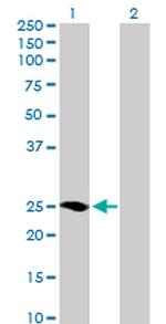 MRAS Antibody in Western Blot (WB)