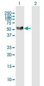 NTNG1 Antibody in Western Blot (WB)