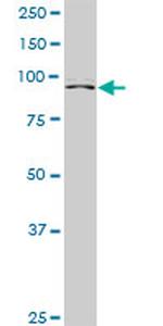 ZHX2 Antibody in Western Blot (WB)