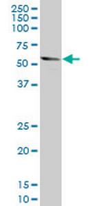 DKK1 Antibody in Western Blot (WB)