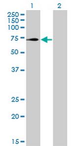 TRIM32 Antibody in Western Blot (WB)